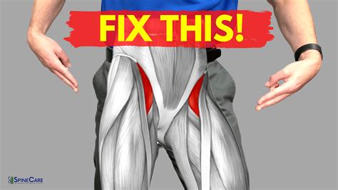 Hip Flexor Pain When Running: Unraveling the Mystery Behind the Ache